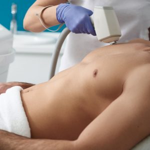 Benefits of Laser Hair Removal: Image of a man having laser hair removal treatments performed on his chest.