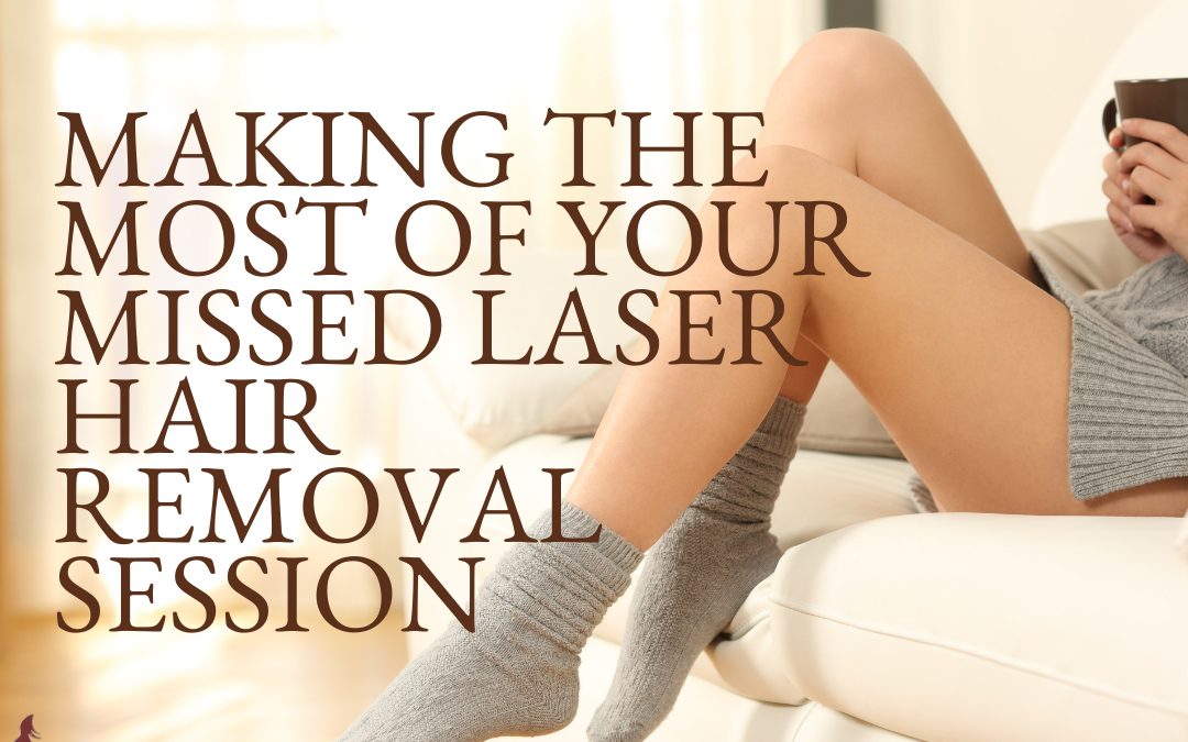 Missed Laser Hair Removal Sessions: Image of a woman with smooth, bare legs sat on a sofa.