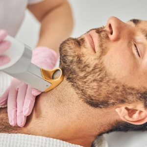 Missed Laser Hair Removal Sessions: Image of a man having laser hair removal performed on his neck.
