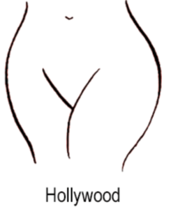 Hollywood laser hair removal